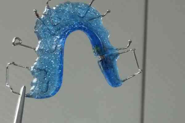 Das Gehalt als Kieferorthop&auml;de - aktuelle Zahlen aus 2025